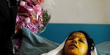 اسید پاشی جنایتکاران افغان به صورت دختران دانش آموز در قندهار