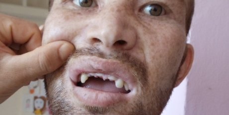 Photo Story: Afghanistani Asylum Seekers In Greece