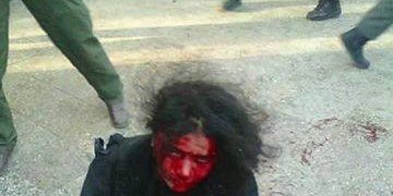 عکس: وحشی های انسان نما زنی را در کابل آتش زدند