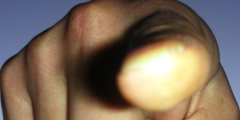 وضعیت حقوق بشر در رژیم صادر شده و مزدور افغانستان 